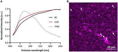 Black carbon particles in human breast milk: assessing infant’s exposure